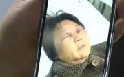 Con dâu hành hung mẹ chồng gãy 4 xương sườn vì không chăm cháu