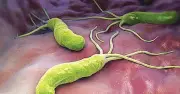 Diệt H. pylori giảm 34% nguy cơ ung thư đại trực tràng