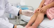 Dấu hiệu cảnh báo bệnh da liễu nguy hiểm ở trẻ cần đi khám ngay
