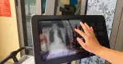 Hà Nội khám sàng lọc miễn phí 12 bệnh mạn tính và ác tính từ 1/7
