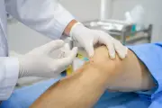Không có phương pháp thần kỳ điều trị thoái hóa khớp gối
