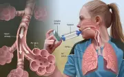 Liệu pháp sinh học: Giải pháp mới cho bệnh nhân hen suyễn nặng