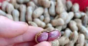 Loại hạt được ca ngợi vừa dinh dưỡng nhưng 2 nhóm người nên tránh xa