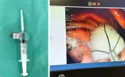 Mải xem điện thoại khi pha bột giảm cân, nam thanh niên nuốt nhầm hộp chống ẩm