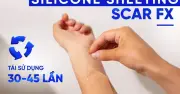 Miếng dán sẹo lồi Scar FX: Giải pháp không xâm lấn cho sẹo lâu năm