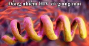 Đồng nhiễm HIV và giang mai: Tầm soát định kỳ ngăn biến chứng thần kinh