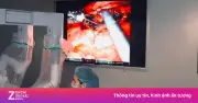 Người phụ nữ 33 tuổi mắc ung thư trực tràng giai đoạn 3, khối u cách hậu môn 3 cm