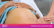 Người trẻ 20-30 tuổi trả giá đắt vì thói quen âm thầm gây kháng insulin