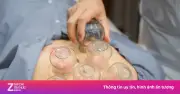 Người trẻ đổ bệnh vì ngồi làm việc quá lâu, đau cổ vai gáy gia tăng