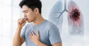 Ngón tay dùi trống cảnh báo ung thư phổi: Dấu hiệu không thể bỏ qua
