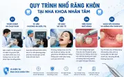 Nhổ răng khôn giá bao nhiêu? Cập nhật bảng giá và quy trình không đau tại Nha Khoa Nhân Tâm