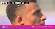 Nốt sần trên mặt Mbappe gây bão mạng xã hội với 60 triệu view
