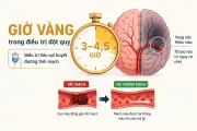 Phát hiện sớm đột quỵ: 'Giờ vàng' quyết định khả năng hồi phục
