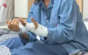 Tê bì tay kéo dài cảnh báo hội chứng ống cổ tay nguy hiểm