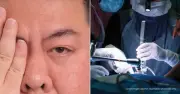Tự tát vào mắt vì mê tín, người đàn ông suýt mù vĩnh viễn do bong võng mạc