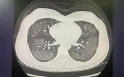 Tài xế nhập viện nguy kịch vì thói quen mớm thức ăn bằng miệng cho vẹt cưng