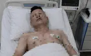 TikToker 'Sói say' qua đời vì suy đa tạng do uống rượu vô độ