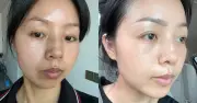 Top 6 serum mờ nám hiệu quả nhất 2026: Từ chân sâu đến sạm màu