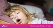 Trẻ ngủ há miệng kéo dài: Dấu hiệu nguy hiểm cần cảnh giác