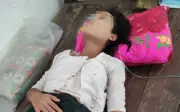 Uống cà phê sữa khi đói: Nữ nhân viên 24 tuổi thủng dạ dày phải cấp cứu
