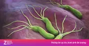 Vi khuẩn HP lây âm thầm qua nhiều thế hệ, gây ung thư dạ dày