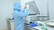 Vinmec điều trị lupus ban đỏ hệ thống bằng liệu pháp CAR-T thành công