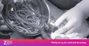 WHO khuyến cáo những nhóm người cần tẩy giun định kỳ để phòng bệnh