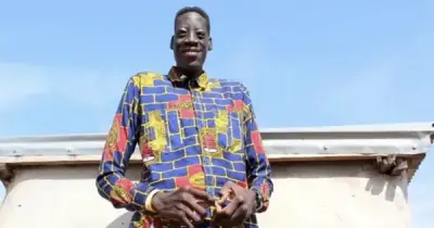 Chàng trai cao nhất Ghana qua đời ở tuổi 31 vì hội chứng Marfan