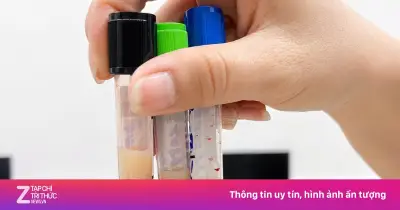 Mẫu máu trắng đục cảnh báo gan tổn thương nặng vì rượu