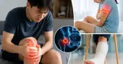 Bác sĩ chỉ ra 3 dấu hiệu ung thư xương cần đi khám sớm