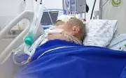 Người đàn ông 70 tuổi suýt chết vì viêm màng não do thịt để tủ lạnh quá lâu