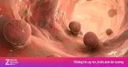 Ung thư đường tiêu hóa: 5 dấu hiệu sớm cần đi khám ngay